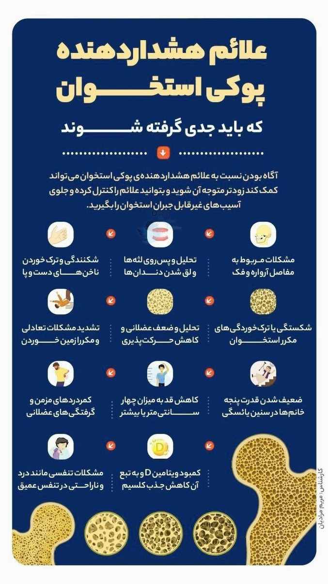 پوکی استخوان